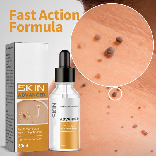 Wart Skin Cleansing Flesh Thorn Wart Cream