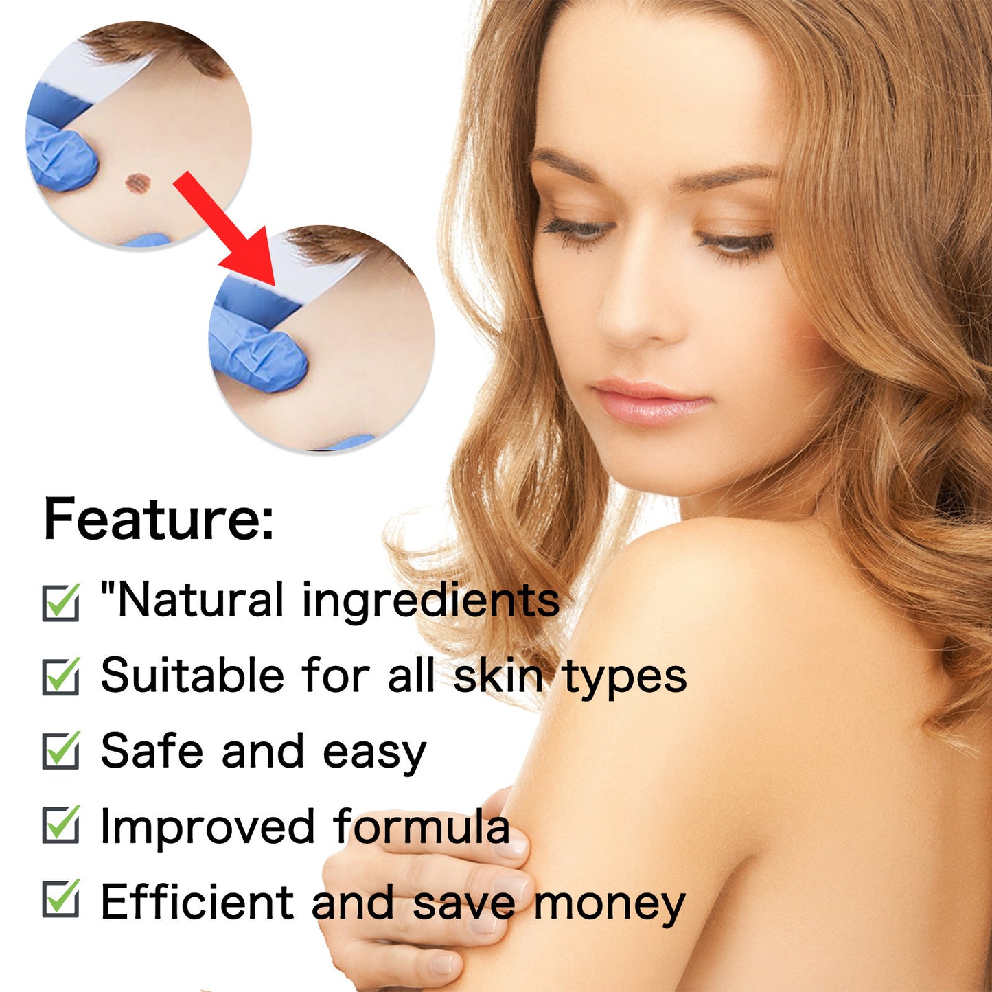 Wart Skin Cleansing Flesh Thorn Wart Cream